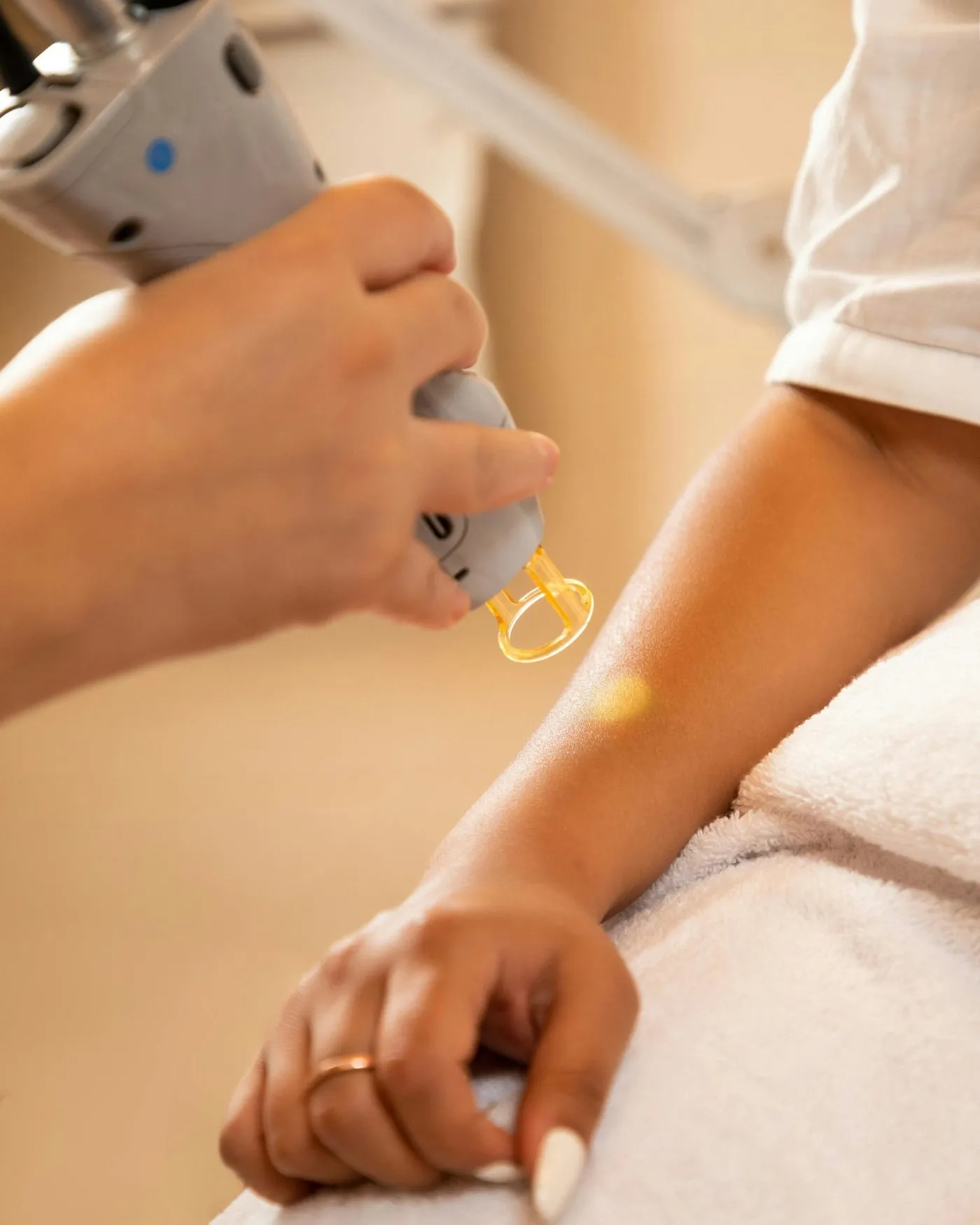 Why It Is Essential to Choose the Best Tattoo Removal Treatment in Milton Keynes