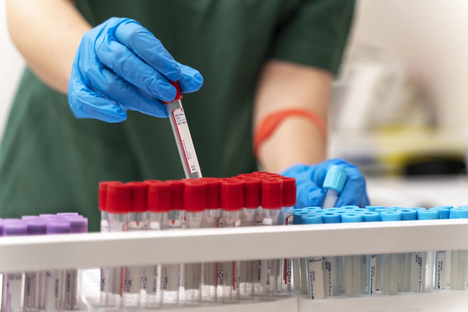 Full Blood Count (CBC)