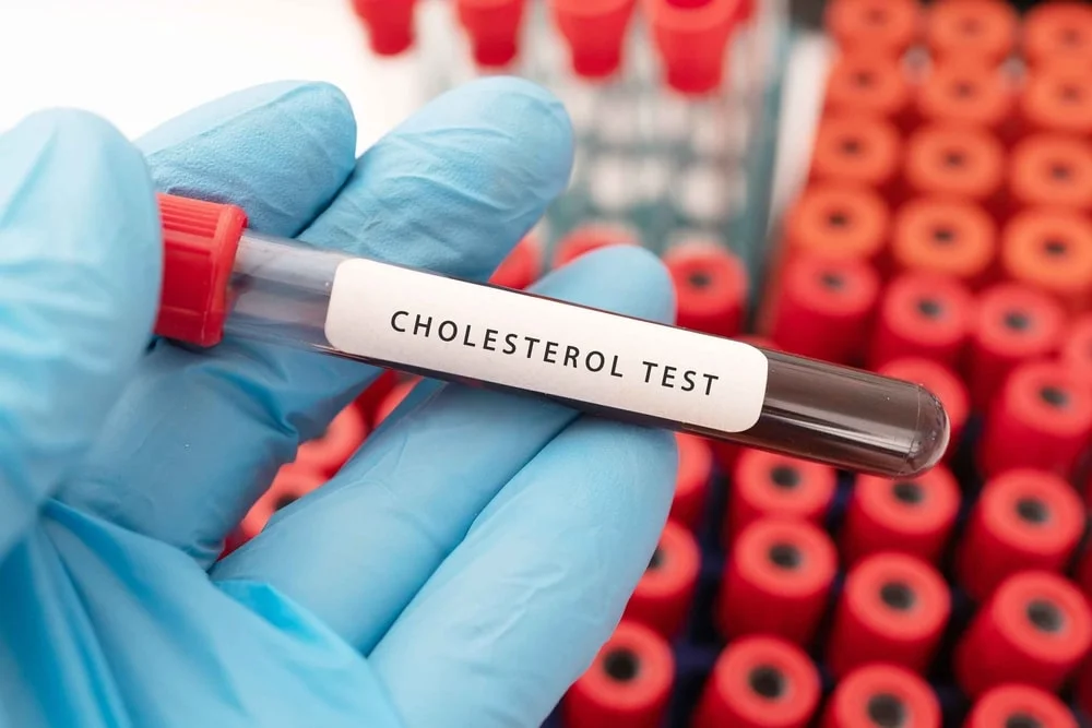 Cholesterol & Lipid Panel