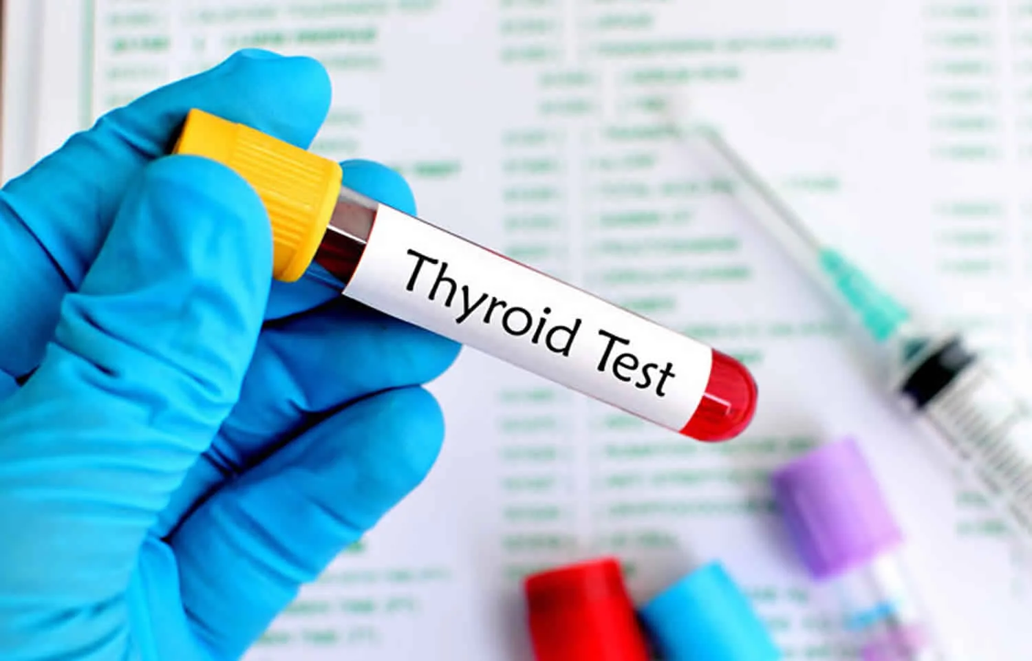 Thyroid Function Test