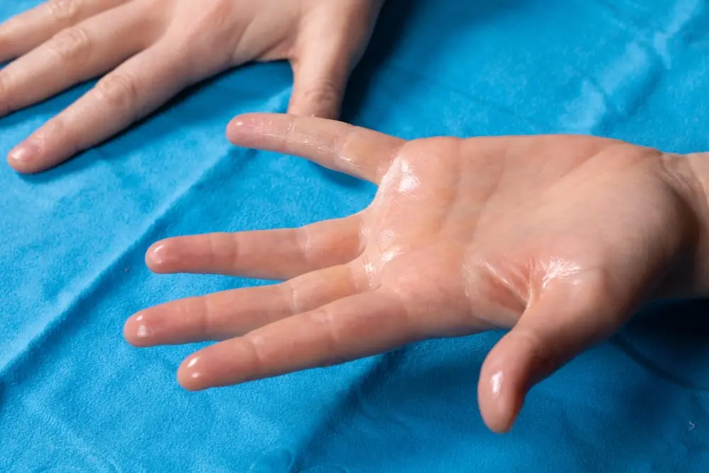  The last option for palmar sweating (hands) is endoscopic thoracic sympathectomy (ETS). 