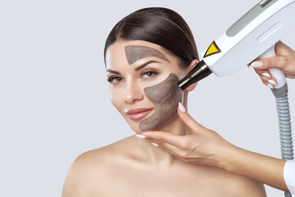 this is medical microneedling