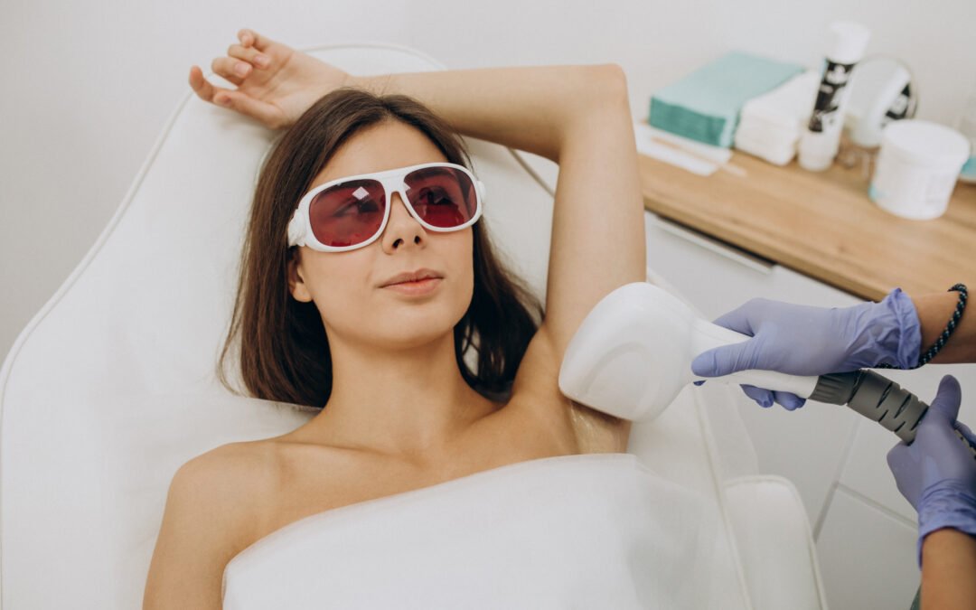 Laser hair removal in Milton Keynes at SVR Aesthetics for safe, long-term hair reduction
