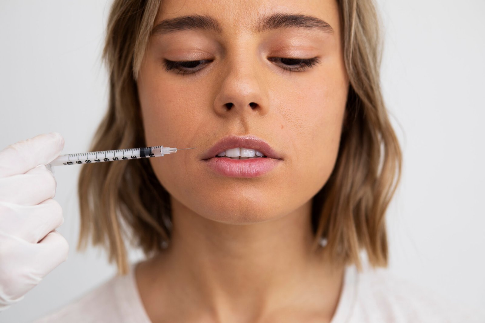Non-surgical lip-enhancing procedure using hyaluronic acid fillers for subtle volume and definition