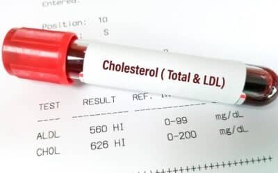 Cholesterol Test Explained: Types, Costs, Results, and What You Need to Know
