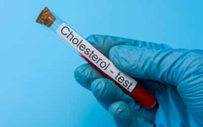 Cholesterol Test in the UK: Accuracy, Home Testing, Fasting, and What It Really Shows