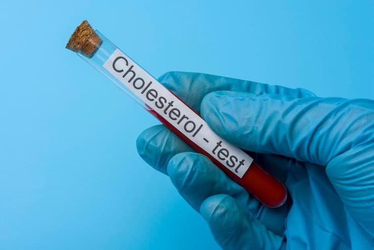 Cholesterol Test in the UK: Accuracy, Home Testing, Fasting, and What It Really Shows