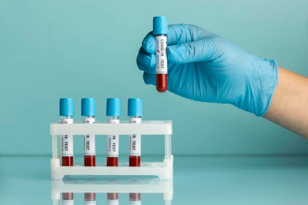 Blood tests in Milton Keynes for accurate diagnosis and health assessment