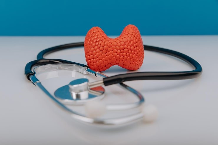 Thyroid function test showing TSH, T3 and T4 hormone levels analysis