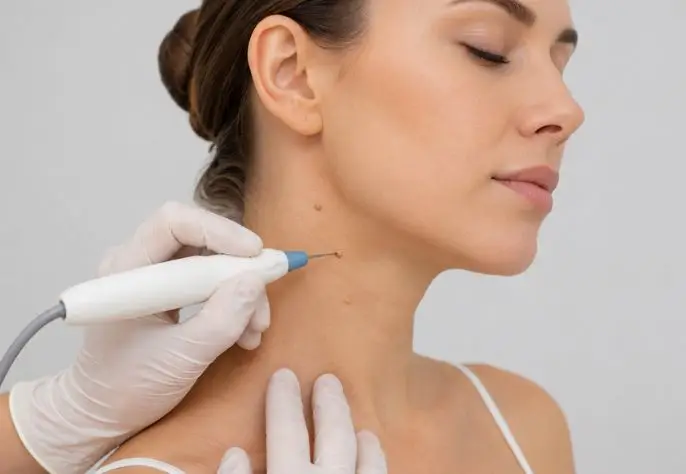 Anti Wrinkle Treatment image