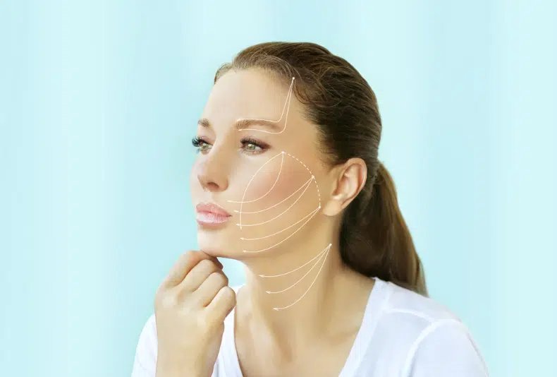 Non-surgical face-lift